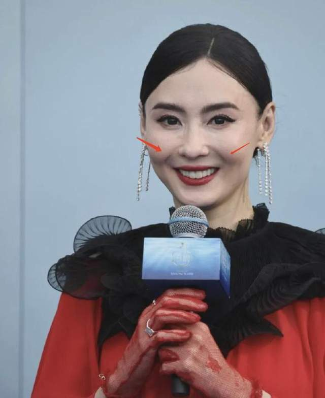 Cecilia Cheung suddenly looks young at 45, suspected of cosmetic surgery - 6 Trương Bá Chi bỗng trẻ lạ ở tuổi 45, bị nghi can thiệp thẩm mỹ - 6