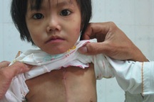 Ngày mai 22/11, bé Thu Trang chính thức được phẫu thuật tim