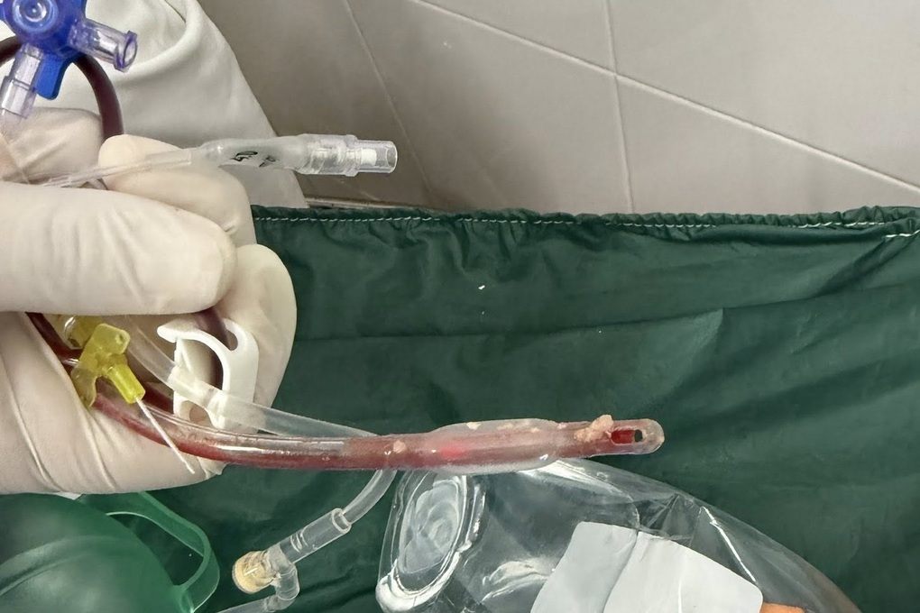 TPHCM: Ho sặc khi ăn ở nhà trẻ, bé gái 3 tuổi tử vong thương tâm - 1