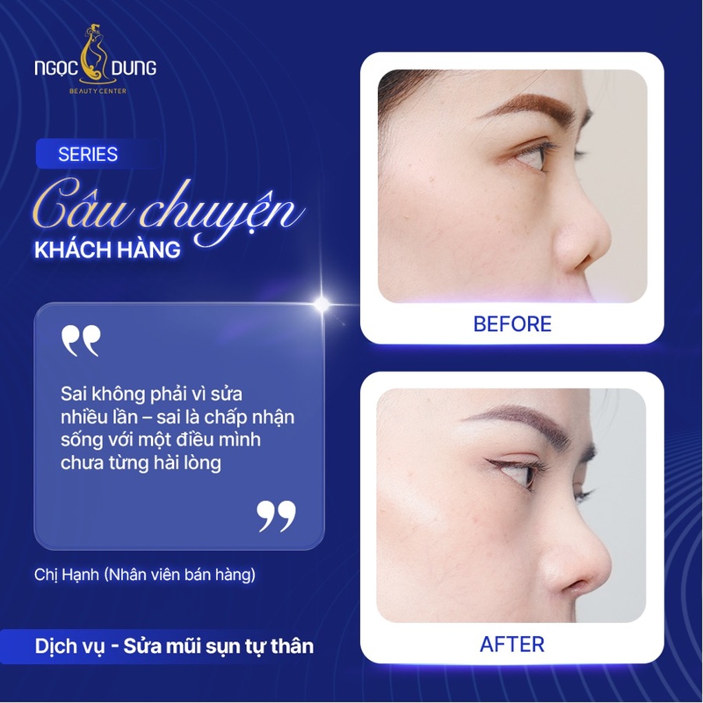 Hành trình vượt qua nỗi sợ dao kéo để chạm tới phiên bản hoàn thiện ở người trẻ - 1 Hành trình vượt qua nỗi sợ dao kéo để chạm tới phiên bản hoàn thiện ở người trẻ
