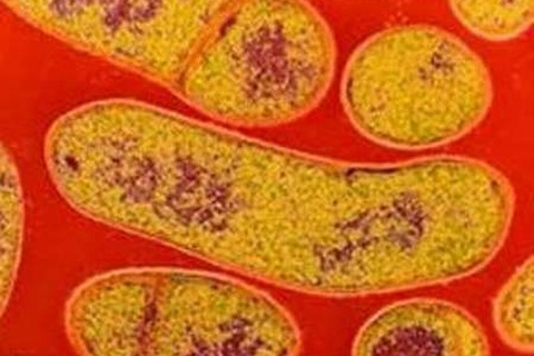 Vi khuẩn độc gây liệt cơ dễ lây qua đường tiêu hóa 