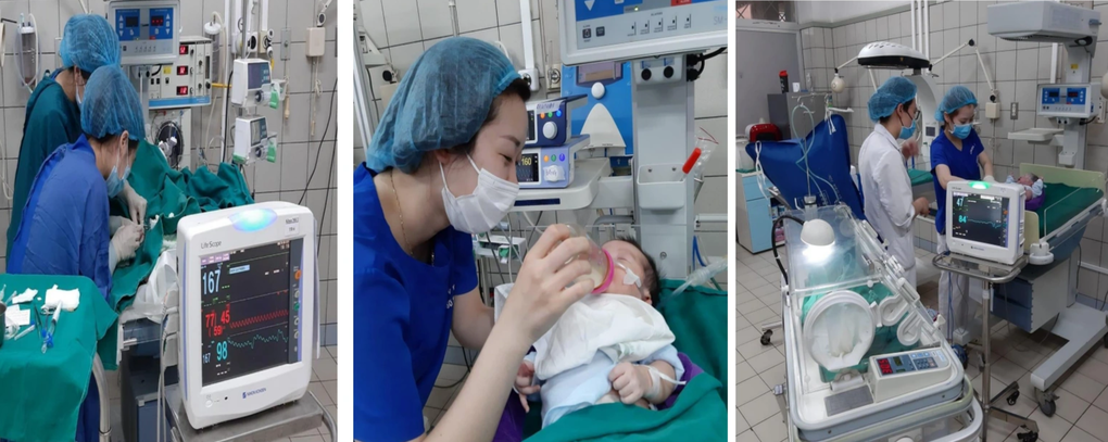Bé sinh non 400g phát triển như thế nào sau một năm? - 2 Bé sinh non 400g phát triển như thế nào sau một năm? - 2
