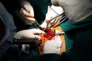 Cân não giành lại sự sống cho bệnh nhân bị dao cắm xuyên ngực