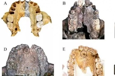 Răng người tiền sử ở Trung Quốc có thể viết lại lịch sử loài người hiện đại