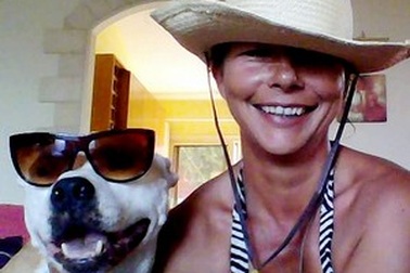 Bào thai song sinh phát triển trong người suốt 45 năm mà không hay biết