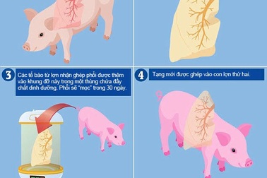 Hy vọng mới cho người cần ghép tạng: Nuôi cấy thành công phổi mới