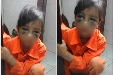 5 vụ bạo lực học đường gây phẫn nộ năm 2016