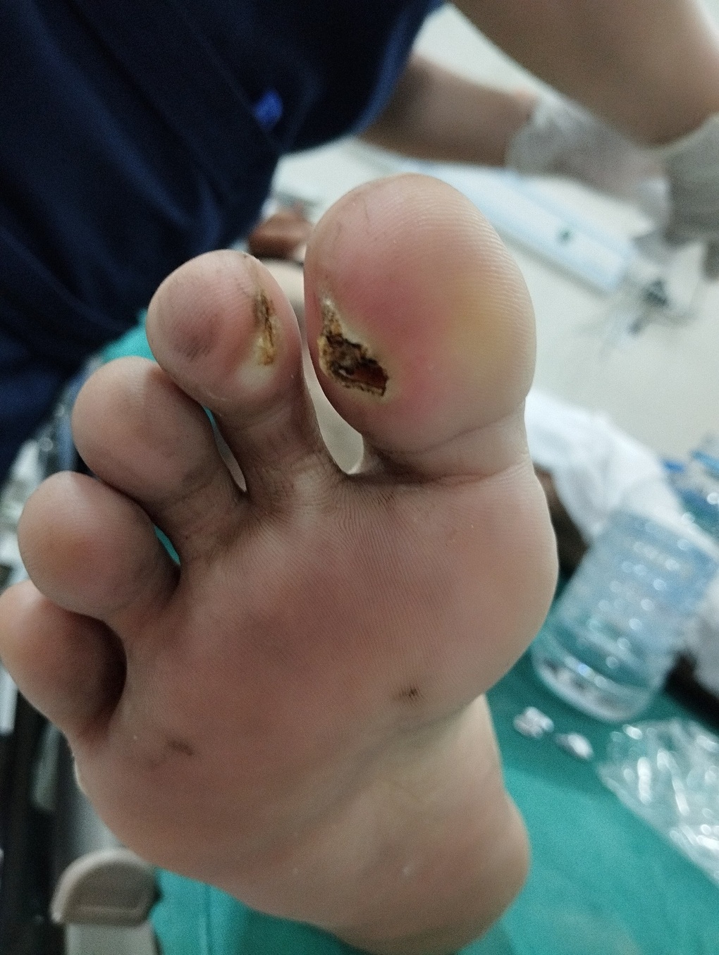 Dùng gậy nhôm gạt dây điện, nam thanh niên bị điện giật - 1 Dùng gậy nhôm gạt dây điện, nam thanh niên bị điện giật - 1