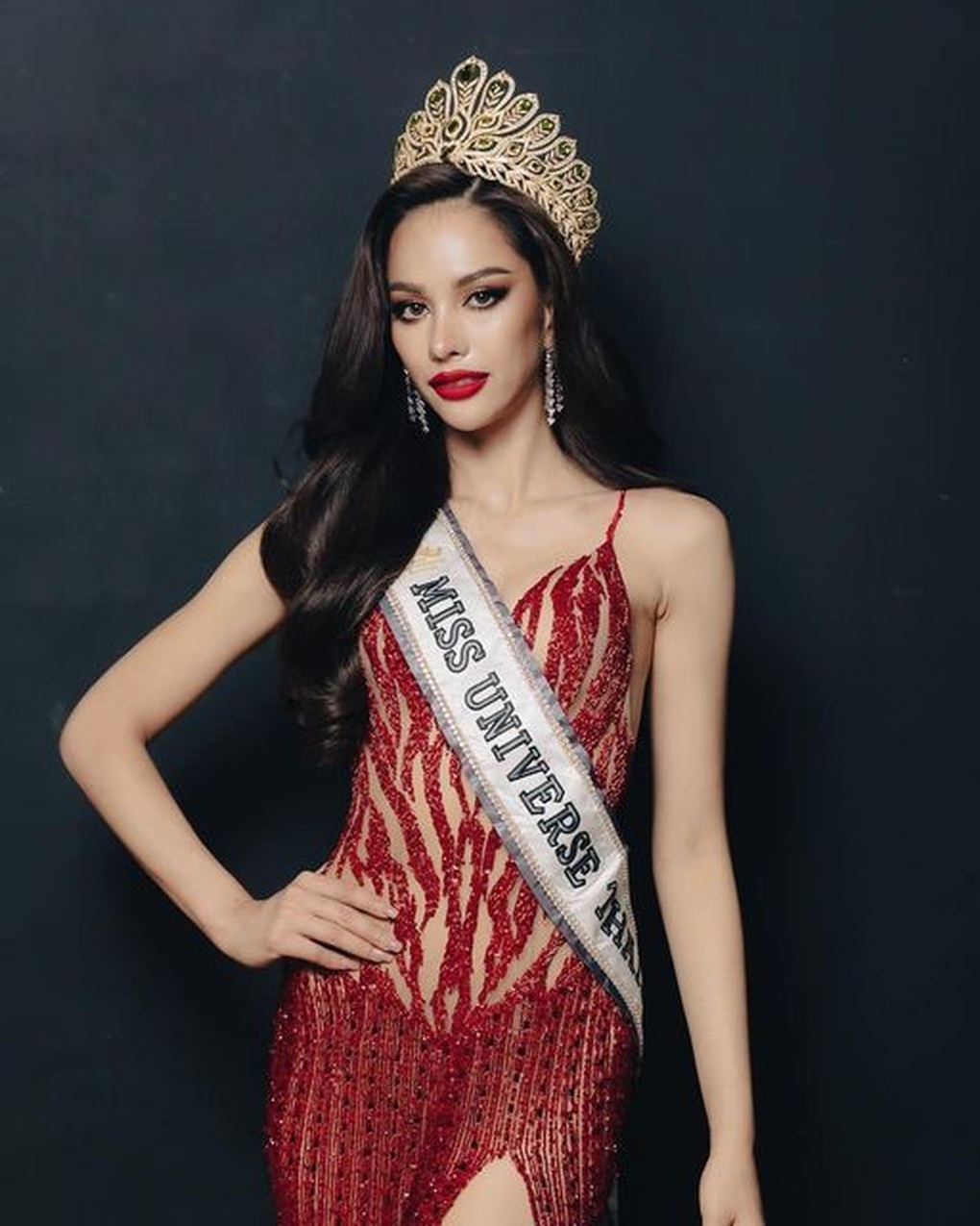 Đối thủ của Ngọc Châu tại HHHV 2022 dính nghi án phẫu thuật thẩm mỹ - 1