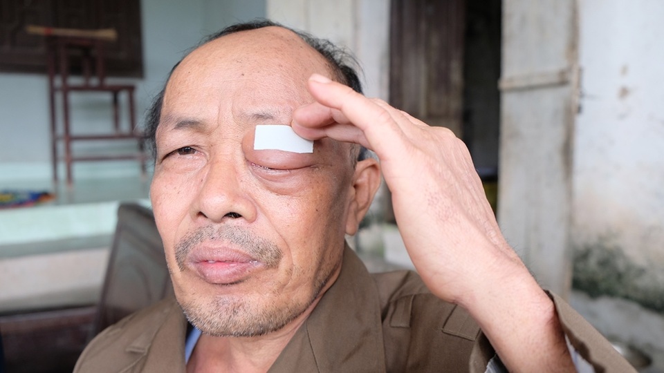 Cận kề cái chết, người vợ cầu xin nhà hảo tâm dang tay cứu chồng - 3 Cận kề cái chết, người vợ cầu xin nhà hảo tâm dang tay cứu chồng - 3