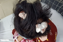 Khởi tố cha dượng đánh đập con gái riêng của vợ