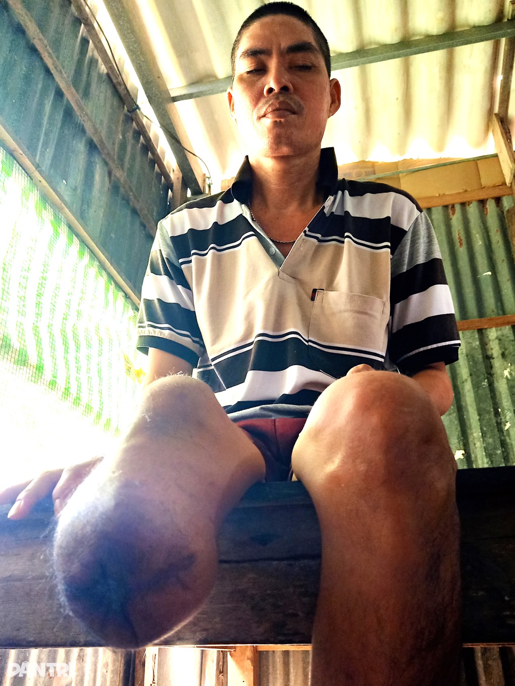 Mẹ bỏ đi, nữ sinh muốn được học tiếp để lo cho cha tật nguyền - 1 Mẹ bỏ đi, nữ sinh muốn được học tiếp để lo cho cha tật nguyền - 1