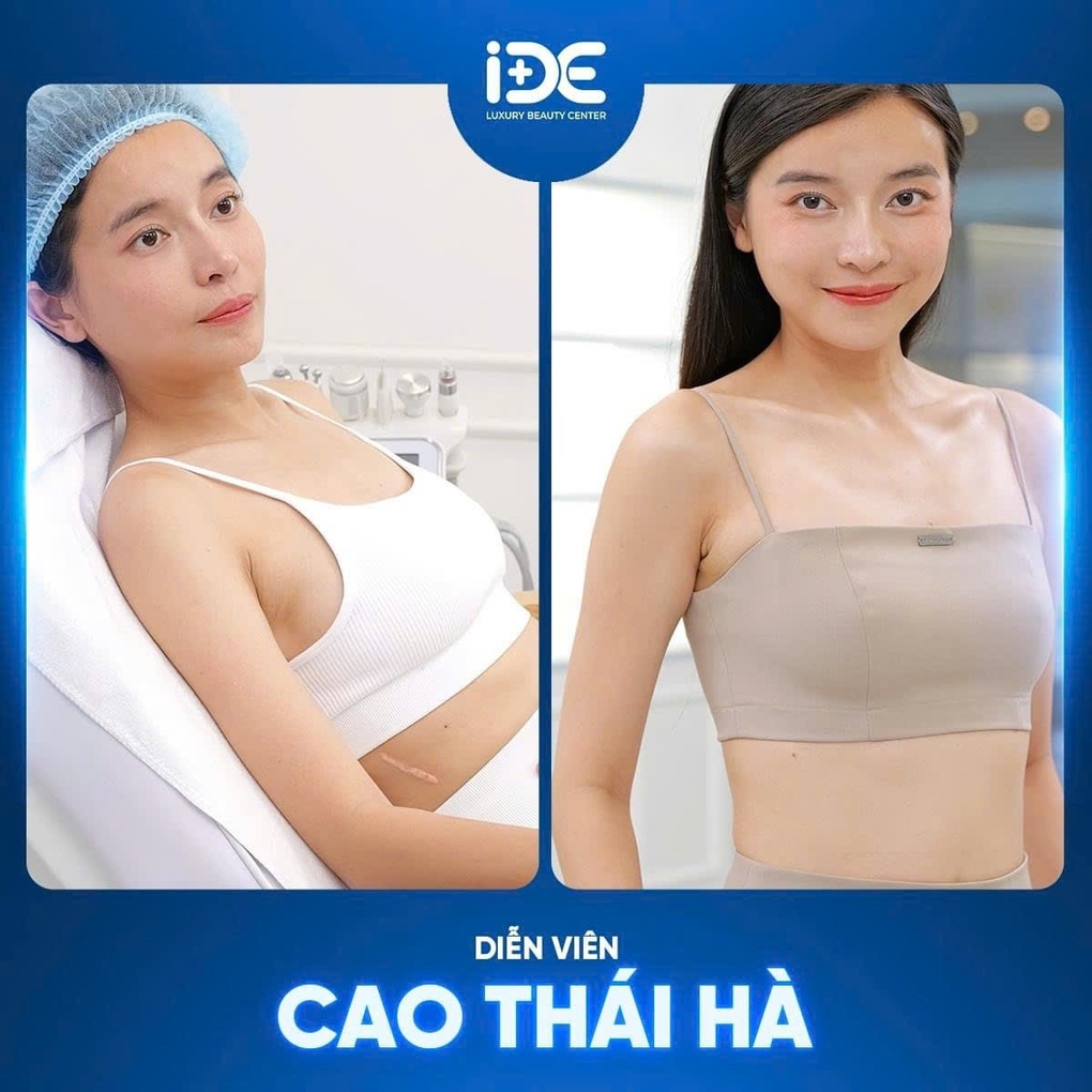 Phòng khám IDE chuyên điều trị sẹo dành cho phụ nữ - 4 Phòng khám IDE chuyên điều trị sẹo dành cho phụ nữ - 4