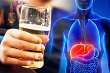 Uống bao nhiêu rượu sẽ gây hại cho gan, làm gì để ngừa xơ gan?