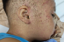 Cứu sống bé trai hơn 3 tuổi nghi bị bạo hành, nhốt trong tủ cấp đông