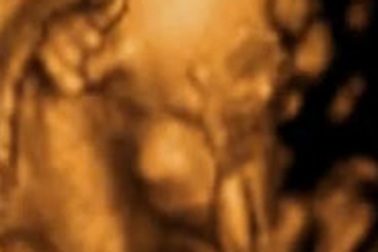 Cười "vỡ bụng" vì thai nhi giơ biểu tượng chữ V