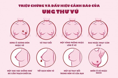 Phát hiện sớm ung thư vú, tỷ lệ chữa khỏi bệnh càng cao