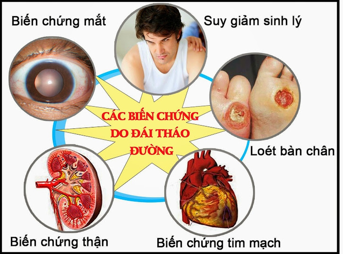 Kiểm soát biến chứng tiểu đường bằng cách nào? - 1 Kiểm soát biến chứng tiểu đường bằng cách nào? - 1