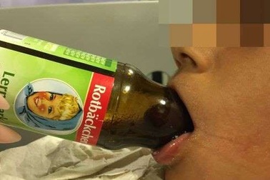 Cậu bé 7 tuổi bị kẹt lưỡi trong chai và cách xử lý xuất sắc của các bác sĩ