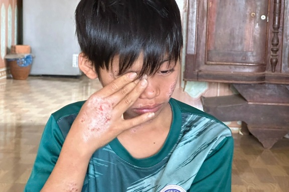 "Giá như mẹ có thể chịu thay con những nỗi đau này!"