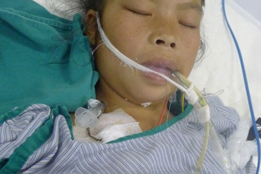 Thương sản phụ mất con, tính mạng nguy kịch sau ca vượt cạn