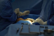 Lựa chọn kích cỡ túi ngực phù hợp với cấu trúc giải phẫu