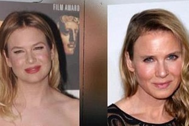 Sao phim “Nhật ký tiểu thư Jones” chấp nhận gương mặt biến dạng vì “dao kéo”