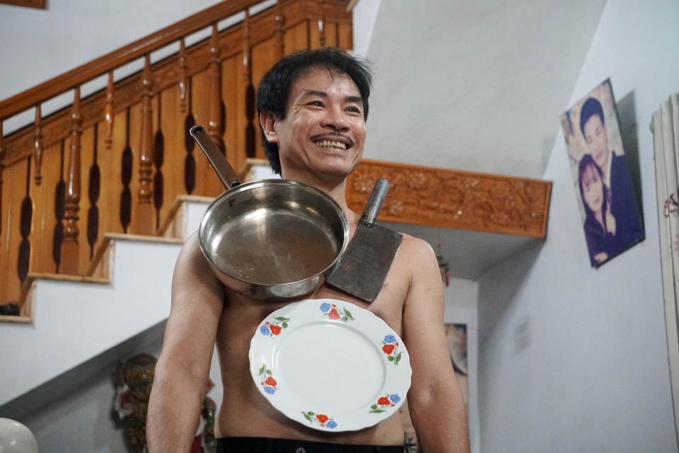 Kỳ lạ người đàn ông như nam châm khổng lồ, hút chặt các đồ vật vào cơ thể - 2