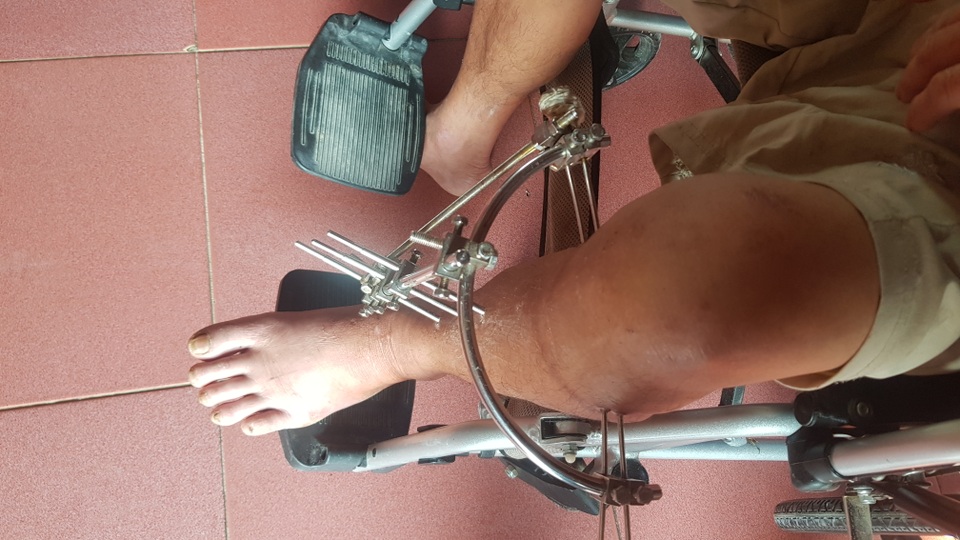 Trao hơn 80 triệu đồng của bạn đọc giúp đỡ gia đình 4 người gặp nạn vật vã trong bệnh viện - 4 Trao hơn 80 triệu đồng của bạn đọc giúp đỡ gia đình 4 người gặp nạn vật vã trong bệnh viện - 4