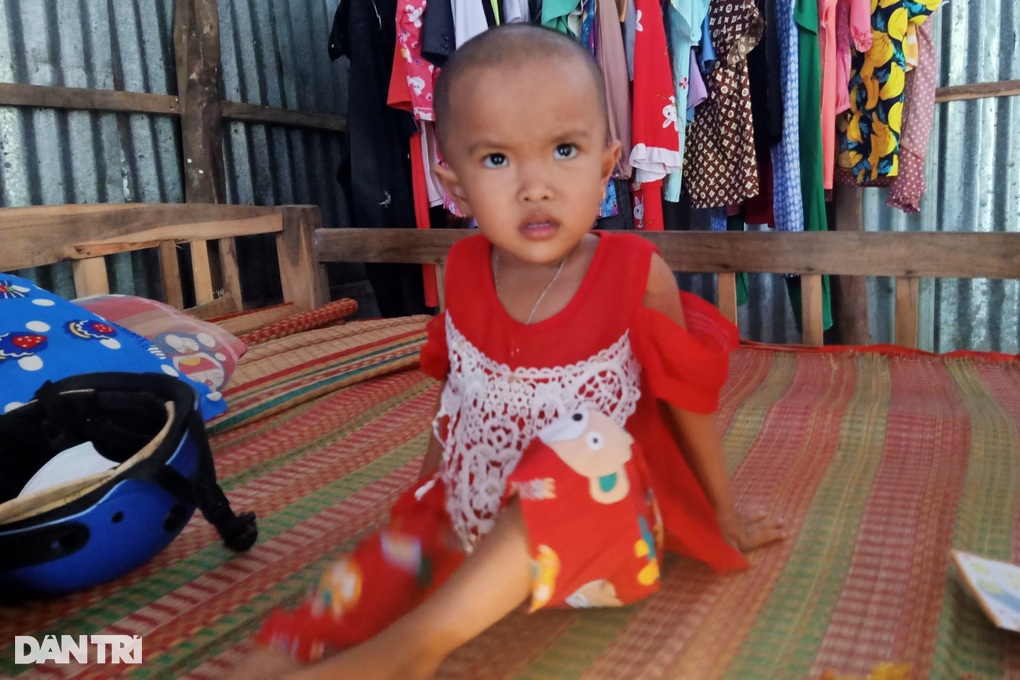Người mẹ Khmer nghèo có con gái bị u gan được giúp gần 400 triệu đồng - 2 Người mẹ Khmer nghèo có con gái bị u gan được giúp gần 400 triệu đồng - 2