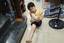 Bé trai 5 tuổi bị vật lạ cứa đứt chân khi tắm biển Nha Trang