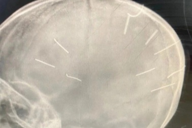 Khi con bị đóng đinh, đánh đập đến chết, bố mẹ ở đó... đứng nhìn