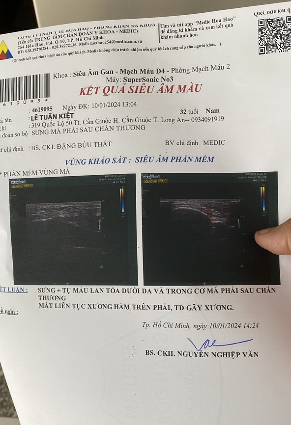 Derrubado em campo, árbitro da VFF se pronuncia para denunciar - 3 Bị đấm gục trên sân, trọng tài VFF lên tiếng tố cáo - 3