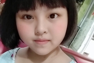 Cô bé dân tộc Sán Dìu bị ung thư đã ra đi mãi mãi