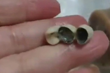 Liên tiếp các vụ phát hiện răng người trong đồ ăn gây xôn xao ở Trung Quốc