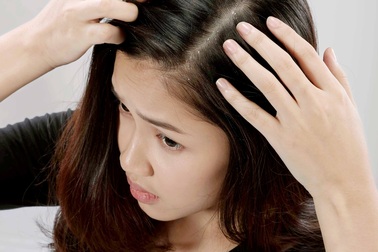 Vì sao không thể "dứt điểm" gàu dù đã thử rất nhiều cách?