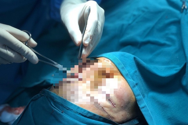 Đằng sau những mũi dao phẫu thuật tạo hình làm thay đổi số phận người bệnh - 8 Đằng sau những mũi dao phẫu thuật tạo hình làm thay đổi số phận người bệnh - 8