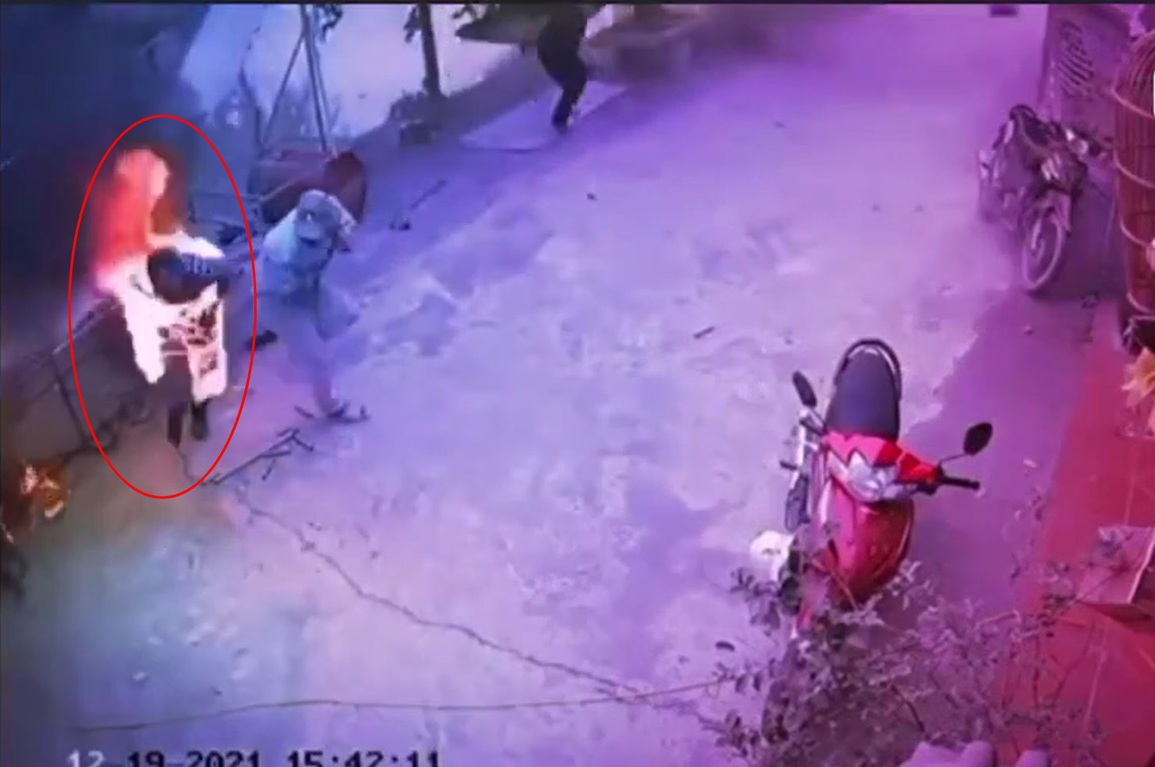 Thợ cắt thùng phuy may mắn có phao cứu sinh khi bị hóa đuốc sống - 1 Thợ cắt thùng phuy may mắn có phao cứu sinh khi bị hóa đuốc sống - 1