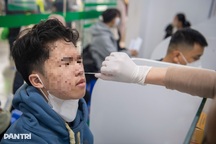 Covid-19 có còn nguy hiểm, triệu chứng khác cúm thế nào?