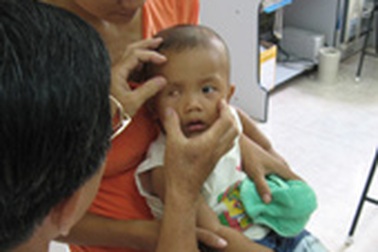 Ung thư trẻ em: Những dấu hiệu nguy hiểm