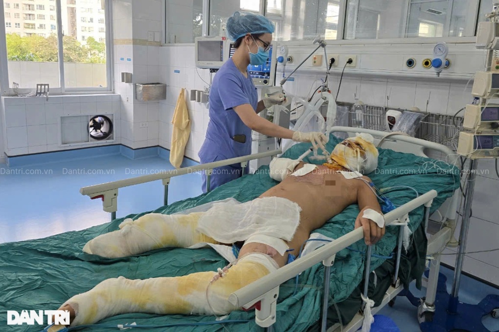 Bác sĩ kêu gọi giúp đỡ người đàn ông mất tay, chân bên phải vì điện cao thế - 1 Bác sĩ kêu gọi giúp đỡ người đàn ông mất tay, chân bên phải vì điện cao thế - 1