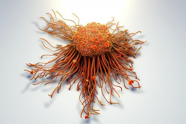 Phát hiện vitamin D có thể "chặn đứng" vũ khí hàng đầu của tế bào ung thư