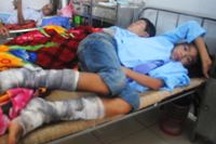 Đốt lửa trại, hơn 70 người nhập viện vì bỏng xăng