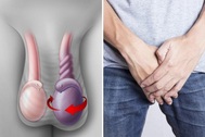 Đang ngủ bỗng đau vùng bìu, bệnh nhân hoảng hồn vì xoắn tinh hoàn