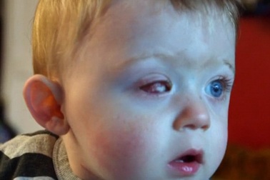 Nhói lòng bé trai bị mất một mắt do cánh quạt máy bay đồ chơi