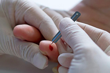 Chích máu dái tai chữa đột quỵ: Người đàn ông suýt gặp họa