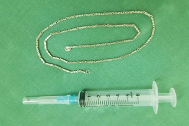 Sợi dây chuyền dài gần 40cm trong dạ dày của trẻ