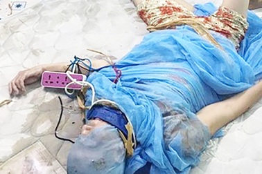 Con đóng đinh vào đầu mẹ để chữa bệnh vì "đạo vô vi"