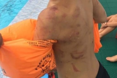 Giờ bơi, thầy hết hồn thấy trên người học trò lớp 3 chi chít vết thương