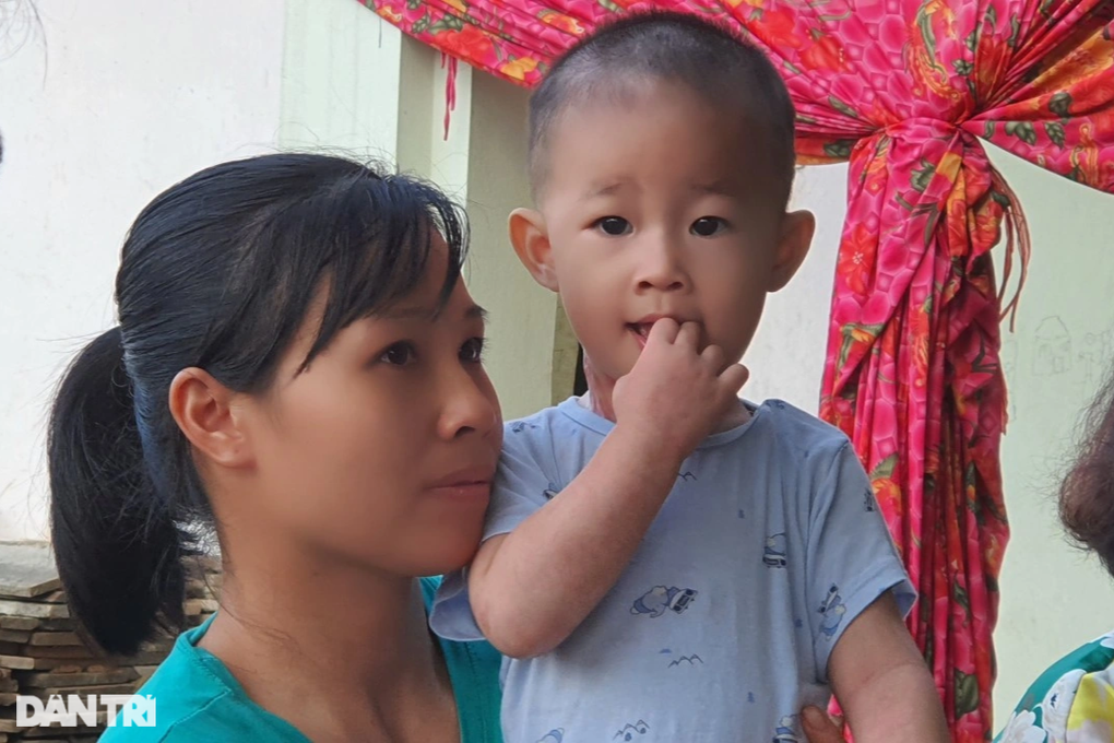Bạn đọc Dân trí giúp đỡ cháu bé bị bỏng nước sôi hơn 600 triệu đồng - 3 Bạn đọc Dân trí giúp đỡ cháu bé bị bỏng nước sôi hơn 600 triệu đồng - 3